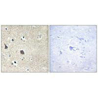 Immunohistochemistry analysis of paraffin-embedded human brain tissue using TRI18 antibody.