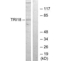 Western blot analysis of extracts from 293 cells, using TRI18 antibody.