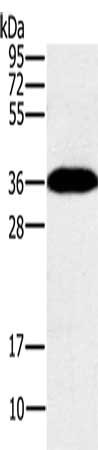 Gel: 10%SDS-PAGE, Lysate: 40 μg, Lane: Mouse brain tissue, Primary antibody: PPP1CC Antibody(PPP1CC Antibody) at dilution 1/200, Secondary antibody: Goat anti rabbit IgG at 1/8000 dilution, Exposure time: 10 secondsRabbit anti-Human PPP1CC Polyclonal Antibody