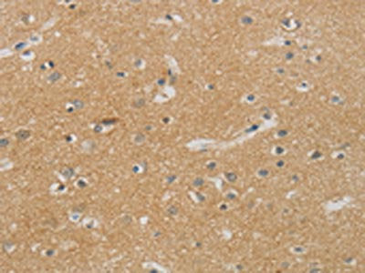 The image on the left is immunohistochemistry of paraffin-embedded Human brain tissue using the antibody Antibody) at dilution 1/70, on the right is treated with synthetic peptide. (Original magnification: ×200)Rabbit anti-Human NDRG1 Polyclonal Antibody