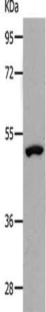 Gel: 10%SDS-PAGE, Lysate: 40 μg, Lane: Human lymphoma tissue, Primary antibody: NDRG1 Antibody(NDRG1 Antibody) at dilution 1/1000, Secondary antibody: Goat anti rabbit IgG at 1/8000 dilution, Exposure time: 10 minutesRabbit anti-Human NDRG1 Polyclonal Antibody