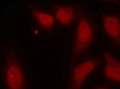 Immunofluorescence staining of methanol-fixed Hela cells using cdc25C(Ab-216) Antibody.Rabbit anti-Human CDC25C Polyclonal Antibody