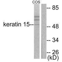 Western blot analysis of extracts from COS7 cells, using Keratin 15 antibody.