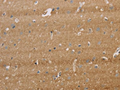 The image on the left is immunohistochemistry of paraffin-embedded Human brain  tissue using IPO9 Antibody(IPO9 Antibody) at dilution 1/40, on the right is treated with synthetic peptide. (Original magnification: ×200)