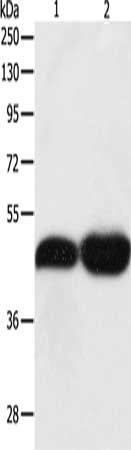 Gel: 10%SDS-PAGE, Lysate: 40 μg, Lane 1-2: NIH/3T3 cells, Lncap cells, Primary antibody: TEKT1 Antibody(TEKT1 Antibody) at dilution 1/500, Secondary antibody: Goat anti rabbit IgG at 1/8000 dilution, Exposure time: 10 minutesRabbit anti-Human TEKT1 Polyclonal Antibody