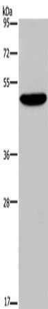 Gel: 8%SDS-PAGE, Lysate: 40 μg, Lane: SKOV3 cells, Primary antibody: PVRL4 Antibody(PVRL4 Antibody) at dilution 1/350, Secondary antibody: Goat anti rabbit IgG at 1/8000 dilution, Exposure time: 1 minuteRabbit anti-Human PVRL4 Polyclonal Antibody