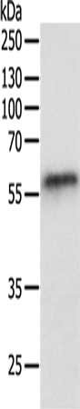 Gel: 10%SDS-PAGE, Lysate: 40 μg, Lane: Human liver cancer tissue, Primary antibody: OCLN Antibody(OCLN Antibody) at dilution 1/200, Secondary antibody: Goat anti rabbit IgG at 1/8000 dilution, Exposure time: 10 minutesRabbit anti-Human OCLN Polyclonal Antibody