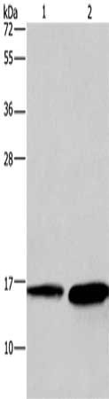 Gel: 12%SDS-PAGE, Lysate: 40 μg, Lane 1-2: Mouse heart tissue, human hepatocellular carcinoma tissue, Primary antibody: HINT2 Antibody(HINT2 Antibody) at dilution 1/300, Secondary antibody: Goat anti rabbit IgG at 1/8000 dilution, Exposure time: 20 secondsRabbit anti-Human HINT2 Polyclonal Antibody