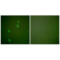 Immunofluorescence analysis of NIH/3T3 cells, using Cullin 2 antibody.Rabbit anti-Human CUL2 Polyclonal Antibody