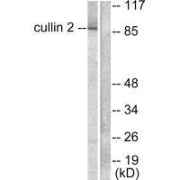 Western blot analysis of extracts from LOVO cells, using Cullin 2 antibody.Rabbit anti-Human CUL2 Polyclonal Antibody