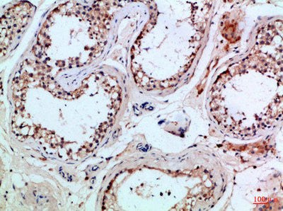 Immunohistochemical analysis of paraffin-embedded Human-testis, antibody was diluted at 1:100Rabbit anti-Human PIK3R2 Polyclonal Antibody