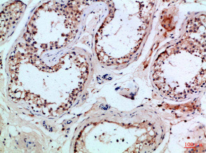 Immunohistochemical analysis of paraffin-embedded Human-testis, antibody was diluted at 1:100Rabbit anti-Human PIK3R2 Polyclonal Antibody