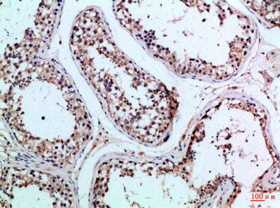 Immunohistochemical analysis of paraffin-embedded Human-testis, antibody was diluted at 1:100Rabbit anti-Human PIK3R2 Polyclonal Antibody