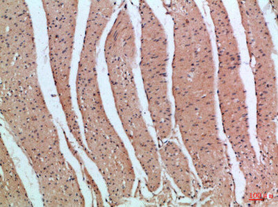 Immunohistochemical analysis of paraffin-embedded Human-colon, antibody was diluted at 1:100Rabbit anti-Human PIK3R2 Polyclonal Antibody