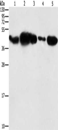 Gel: 10%SDS-PAGE, Lysate: 40 μg, Lane 1-5: HepG2 cells, human fetal placenta tissue, 293T cells, human testis tissue, NIH/3T3 cells, Primary antibody: PGK2 Antibody(PGK2 Antibody) at dilution 1/600, Secondary antibody: Goat anti rabbit IgG at 1/8000 dilution, Exposure time: 5 secondsRabbit anti-Human PGK2 Polyclonal Antibody