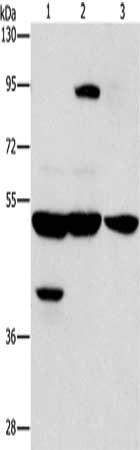 Gel: 6%SDS-PAGE, Lysate: 40 μg, Lane 1-3: Human bladder carcinoma tissue, A172 cells, human brain malignant glioma tissue, Primary antibody: STK4 Antibody(STK3/STK4 Antibody) at dilution 1/1000, Secondary antibody: Goat anti rabbit IgG at 1/8000 dilution, Exposure time: 10 secondsRabbit anti-Human STK4 Polyclonal Antibody