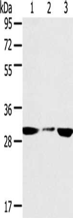 Gel: 8%SDS-PAGE, Lysate: 40 μg, Lane 1-3: PC3 cells, hepg2 cells, human fetal liver tissue, Primary antibody: SDHB Antibody(SDHB Antibody) at dilution 1/400, Secondary antibody: Goat anti rabbit IgG at 1/8000 dilution, Exposure time: 30 seconds