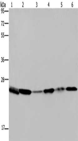 Gel: 10%SDS-PAGE, Lysate: 40 μg, Lane 1-6: Mouse spleen tissue, A375 cells, A549 cells, HT29 cells, mouse lung  tissue, Hela cells, Primary antibody: ARHGDIA Antibody(ARHGDIA Antibody) at dilution 1/400, Secondary antibody: Goat anti rabbit IgG at 1/8000 dilution, Exposure time: 10 secondsRabbit anti-Human ARHGDIA Polyclonal Antibody