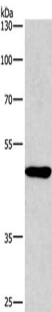 Gel: 10%SDS-PAGE, Lysate: 60 μg, Lane: A549 cells, Primary antibody: BMP15 Antibody(BMP15 Antibody) at dilution 1/266.7, Secondary antibody: Goat anti rabbit IgG at 1/8000 dilution, Exposure time: 5 minutes