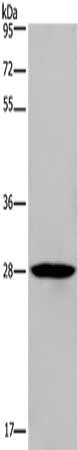 Gel: 10%SDS-PAGE, Lysate: 40 μg, Lane: Human bladder carcinoma tissue, Primary antibody: KLRF1 Antibody(KLRF1 Antibody) at dilution 1/300, Secondary antibody: Goat anti rabbit IgG at 1/8000 dilution, Exposure time: 2 minutes