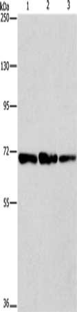 Gel: 8%SDS-PAGE, Lysate: 40 μg, Lane 1-3: A172 cells, K562 cells, hela cells, Primary antibody: FARSB Antibody(FARSB Antibody) at dilution 1/225, Secondary antibody: Goat anti rabbit IgG at 1/8000 dilution, Exposure time: 1 minuteRabbit anti-Human FARSB Polyclonal Antibody