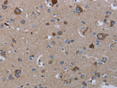 The image on the left is immunohistochemistry of paraffin-embedded Human brain  tissue using NDUFS8 Antibody(NDUFS8 Antibody) at dilution 1/20, on the right is treated with fusion protein. (Original magnification: ×200)Rabbit anti-Human NDUFS8 Polyclonal Antibody