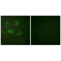 Immunofluorescence analysis of HuvEc cells, using Claudin 3 antibody.Rabbit anti-Human CLDN3 Polyclonal Antibody