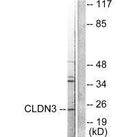 Western blot analysis of extracts from HuvEc cells, using Claudin 3 antibody.Rabbit anti-Human CLDN3 Polyclonal Antibody