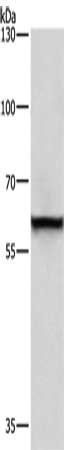 Gel: 6%SDS-PAGE, Lysate: 40 μg, Lane: A431 cells, Primary antibody: TRIP4 Antibody(TRIP4 Antibody) at dilution 1/400, Secondary antibody: Goat anti rabbit IgG at 1/8000 dilution, Exposure time: 10 secondsRabbit anti-Human TRIP4 Polyclonal Antibody