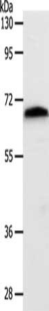 Gel: 10%SDS-PAGE, Lysate: 40 μg, Lane: Mouse liver tissue, Primary antibody: SLC22A3 Antibody(SLC22A3 Antibody) at dilution 1/400, Secondary antibody: Goat anti rabbit IgG at 1/8000 dilution, Exposure time: 1 minuteRabbit anti-Human SLC22A3 Polyclonal Antibody