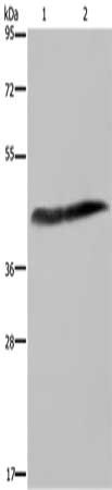Gel: 8%SDS-PAGE, Lysate: 40 μg, Lane 1-2: Human placenta tissue, HepG2 cells, Primary antibody: CSF2RA Antibody(CSF2RA Antibody) at dilution 1/250, Secondary antibody: Goat anti rabbit IgG at 1/8000 dilution, Exposure time: 3 secondsRabbit anti-Human CSF2RA Polyclonal Antibody
