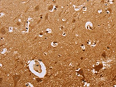 The image on the left is immunohistochemistry of paraffin-embedded Human brain  tissue using CEL Antibody(CEL Antibody) at dilution 1/50, on the right is treated with synthetic peptide. (Original magnification: ×200)