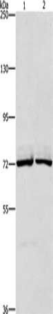 Gel: 6%SDS-PAGE, Lysate: 40 μg, Lane 1-2: Hela cells, hepG2 cells, Primary antibody: CEL Antibody(CEL Antibody) at dilution 1/550, Secondary antibody: Goat anti rabbit IgG at 1/8000 dilution, Exposure time: 3 minutes