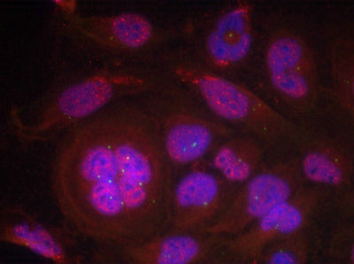 Immunofluorescence staining of methanol-fixed Hela cells using NFκB-p65 (Phospho-Ser276) Antibody.Rabbit anti-Human RELA Polyclonal Antibody