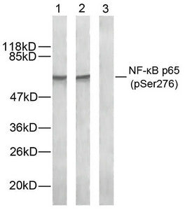 Western blot analysis of extract from Hela cells using NF-κB p65 (phospho-Ser276) antibody. Lane 1: The antibody is not preincubated with blocking peptides. Lane 2: The antibody is preincubated with non- phospho peptide blocking peptides. Lane 3: The antibody is preincubated with phospho peptide blocking peptides.Rabbit anti-Human RELA Polyclonal Antibody
