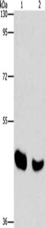 Gel: 8%SDS-PAGE, Lysate: 40 μg, Lane 1-2: Human normal liver tissue, mouse pancreas tissue, Primary antibody: BAAT Antibody(BAAT Antibody) at dilution 1/650, Secondary antibody: Goat anti rabbit IgG at 1/8000 dilution, Exposure time: 10 seconds