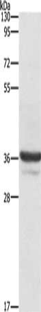 Gel: 10%SDS-PAGE, Lysate: 40 μg, Lane: Lovo cells, Primary antibody: ANXA3 Antibody(ANXA3 Antibody) at dilution 1/650, Secondary antibody: Goat anti rabbit IgG at 1/8000 dilution, Exposure time: 1 secondRabbit anti-Human ANXA3 Polyclonal Antibody
