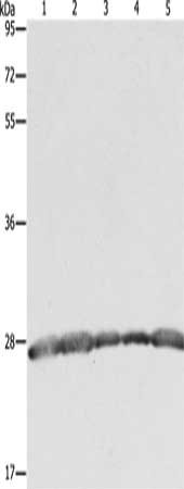 Gel: 10%SDS-PAGE, Lysate: 40 μg, Lane 1-5: Hela cells, 293T cells, MCF7 cells, human fetal brain tissue, Jurkat cells, Primary antibody: PRDX3 Antibody(PRDX3 Antibody) at dilution 1/800, Secondary antibody: Goat anti rabbit IgG at 1/8000 dilution, Exposure time: 2 secondsRabbit anti-Human PRDX3 Polyclonal Antibody