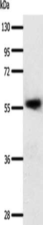 Gel: 10%SDS-PAGE, Lysate: 40 μg, Lane: Human esophagus cancer tissue, Primary antibody: SLC22A17 Antibody(SLC22A17 Antibody) at dilution 1/600, Secondary antibody: Goat anti rabbit IgG at 1/8000 dilution, Exposure time: 20 secondsRabbit anti-Human SLC22A17 Polyclonal Antibody