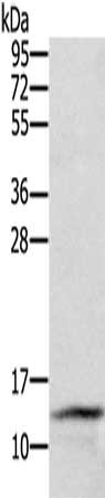 Gel: 12%SDS-PAGE, Lysate: 40 μg, Lane: Lovo cells, Primary antibody: CST2 Antibody(CST2 Antibody) at dilution 1/300, Secondary antibody: Goat anti rabbit IgG at 1/8000 dilution, Exposure time: 5 minutesRabbit anti-Human CST2 Polyclonal Antibody