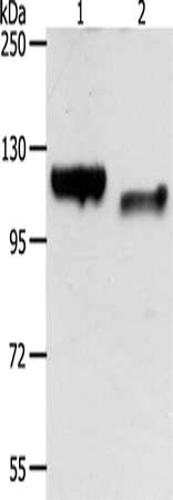 Gel: 8%SDS-PAGE, Lysate: 40 μg, Lane 1-2: HepG2 cells, mouse brain tissue, Primary antibody: CDH3 Antibody(CDH3 Antibody) at dilution 1/100, Secondary antibody: Goat anti rabbit IgG at 1/8000 dilution, Exposure time: 1 minuteRabbit anti-Human CDH3 Polyclonal Antibody