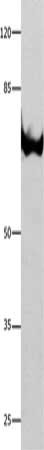 Gel: 8%SDS-PAGE, Lysate: 30 μg, Lane: 293T cells, Primary antibody: ANXA6 Antibody(ANXA6 Antibody) at dilution 1/350, Secondary antibody: Goat anti rabbit IgG at 1/8000 dilution, Exposure time: 10 secondsRabbit anti-Human ANXA6 Polyclonal Antibody