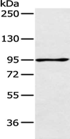 Gel: 6%SDS-PAGE, Lysate: 40 μg, Lane: 293T cell, Primary antibody: AGBL2 Antibody(AGBL2 Antibody) at dilution 1/200 dilution, Secondary antibody: Goat anti rabbit IgG at 1/8000 dilution, Exposure time: 1 minuteRabbit anti-Human AGBL2 Polyclonal Antibody