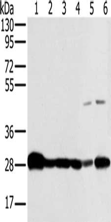 Gel: 8%SDS-PAGE, Lysate: 40 μg, Lane 1-6: Mouse brain tissue, human fetal brain tissue, hela cells, Raw264.7 cells, NIH/3T3 cells, 293T cells, Primary antibody: NDUFS3 Antibody(NDUFS3 Antibody) at dilution 1/300, Secondary antibody: Goat anti rabbit IgG at 1/8000 dilution, Exposure time: 5 secondsRabbit anti-Human NDUFS3 Polyclonal Antibody