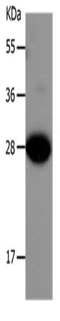 Gel: 10%SDS-PAGE, Lysate: 30 μg, Lane: Mouse liver tissue, Primary antibody: IGFBP1 Antibody(IGFBP1 Antibody) at dilution 1/550, Secondary antibody: Goat anti rabbit IgG at 1/8000 dilution, Exposure time: 1 minute