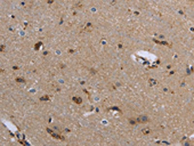 The image on the left is immunohistochemistry of paraffin-embedded Human brain  tissue using FIS1 Antibody(FIS1 Antibody) at dilution 1/20, on the right is treated with fusion protein. (Original magnification: ×200)Rabbit anti-Human FIS1 Polyclonal Antibody