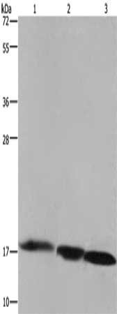 Gel: 10%SDS-PAGE, Lysate: 40 μg, Lane 1-3: Raji cells, mouse liver tissue, Mouse heart tissue, Primary antibody: FIS1 Antibody(FIS1 Antibody) at dilution 1/500, Secondary antibody: Goat anti rabbit IgG at 1/8000 dilution, Exposure time: 1 minuteRabbit anti-Human FIS1 Polyclonal Antibody