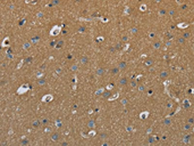 The image on the left is immunohistochemistry of paraffin-embedded Human brain  tissue using PAEP Antibody(PAEP Antibody) at dilution 1/60, on the right is treated with fusion protein. (Original magnification: ×200)Rabbit anti-Human PAEP Polyclonal Antibody