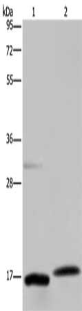 Gel: 10%SDS-PAGE, Lysate: 40 μg, Lane 1-2: Mouse adrenal gland tissue, Mouse liver tissue, Primary antibody: PAEP Antibody(PAEP Antibody) at dilution 1/250, Secondary antibody: Goat anti rabbit IgG at 1/8000 dilution, Exposure time: 1 minuteRabbit anti-Human PAEP Polyclonal Antibody