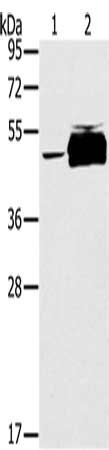 Gel: 8%SDS-PAGE, Lysate: 40 μg, Lane 1-2: K562 cells, human testis tissue, Primary antibody: PTPN20A; Antibody(PTPN20B Antibody) at dilution 1/200, Secondary antibody: Goat anti rabbit IgG at 1/8000 dilution, Exposure time: 1 minuteRabbit anti-Human PTPN20A; Polyclonal Antibody
